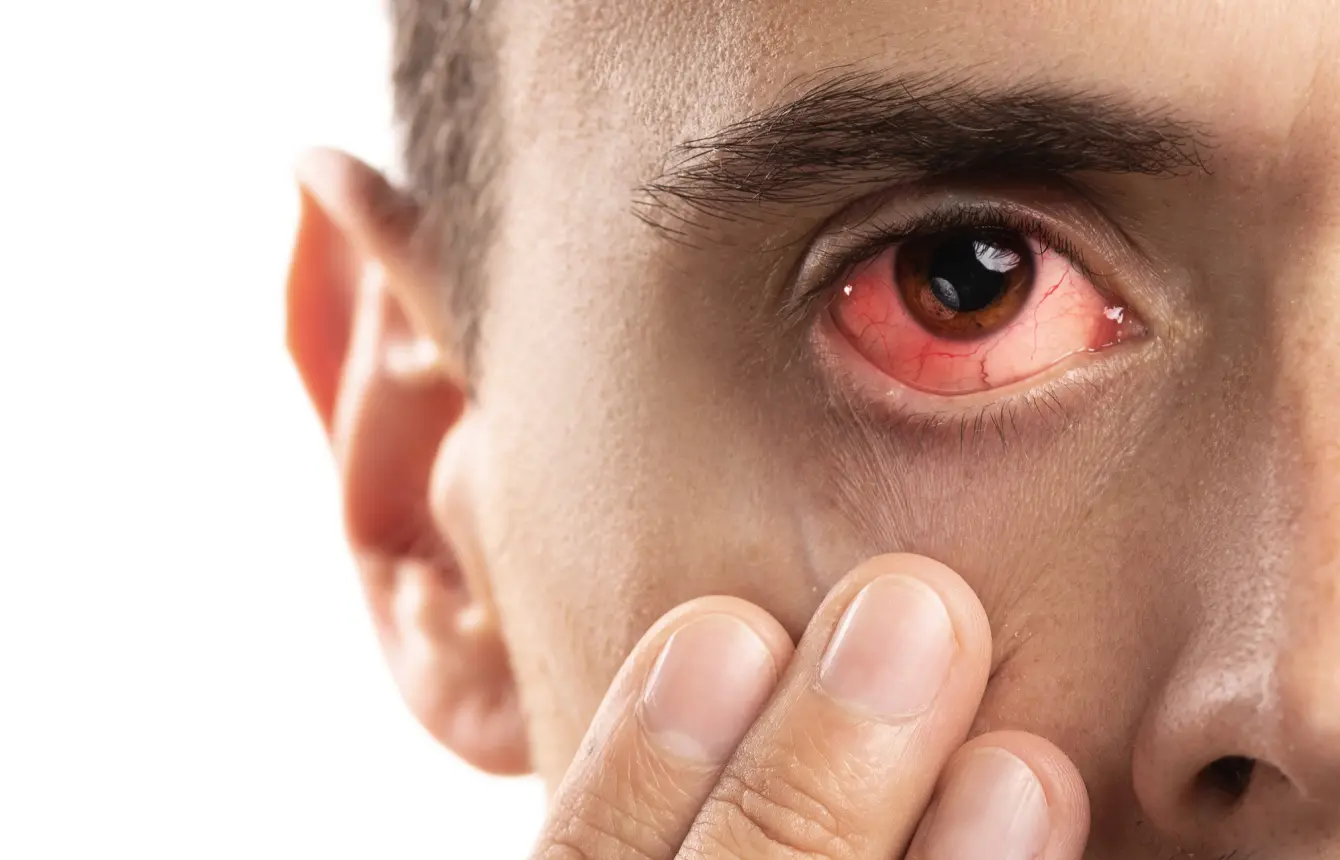 Tratamiento de ojo seco